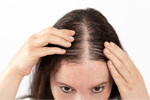 Hair problem treatment for hair fall and scalp issues